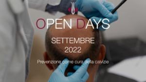 open days calvizie