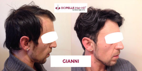 Gianni_fb