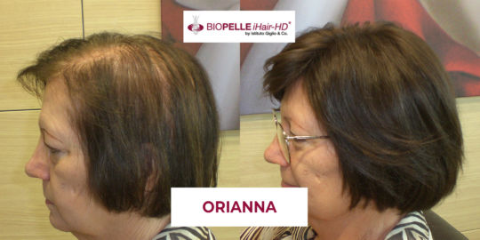 Orianna_2_fb