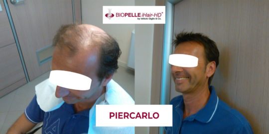 Piercarlo_fb