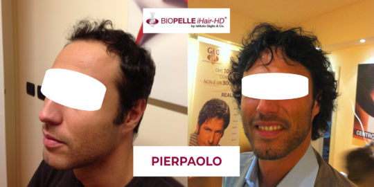 Pierpaolo_fb