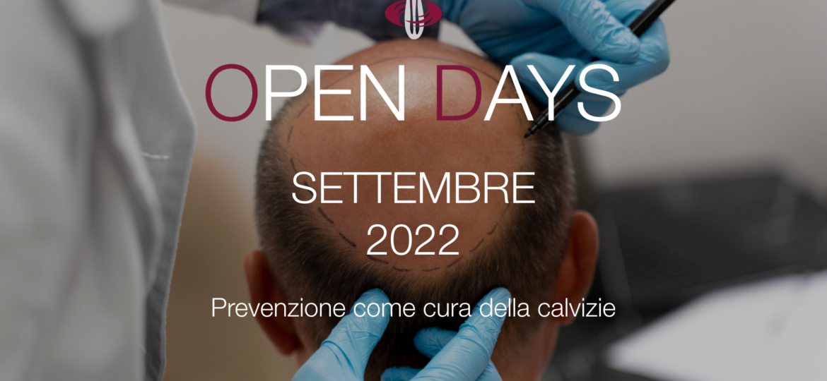 open days calvizie